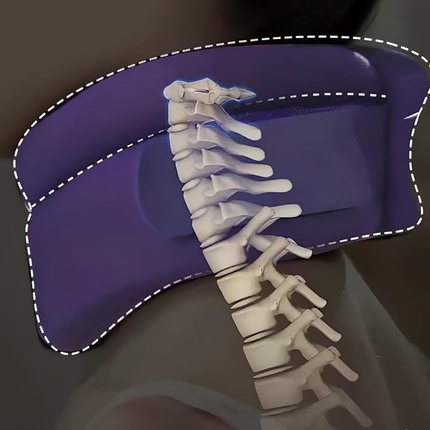 SnoreLess™ - Soporte Ergonómico para el Cuello Antirronquidos y Alineación Cervical